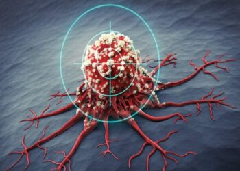 معرفی روش جدیدی برای تشخیص زودهنگام سرطان تخمدان