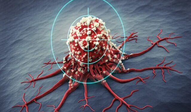 معرفی روش جدیدی برای تشخیص زودهنگام سرطان تخمدان