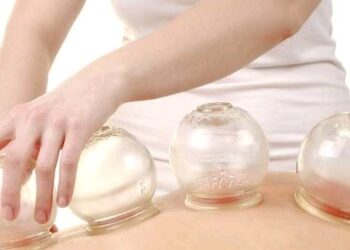 خدمات «فصد و حجامت» بیمه شد