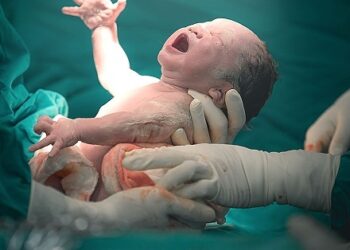 هشدار به مادران باردار درباره سزارین‌های تقویمی