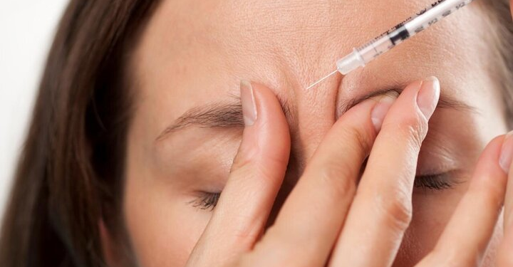 ۱۱ گروهی که به‌هیچ وجه نباید بوتاکس تزریق کنند