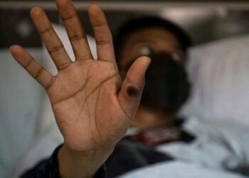 آبله میمونی؛ سایه ترسناک یک ویروس شبیه کرونا