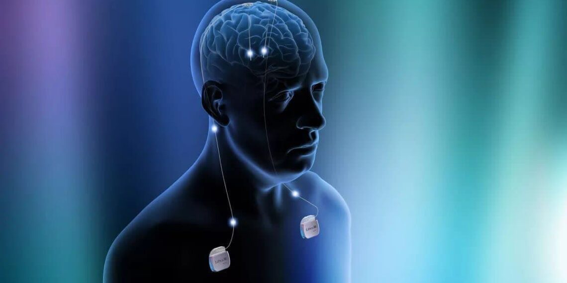  درمان نوین پارکینسون با استفاده از دستگاه کاشته شده در مغز