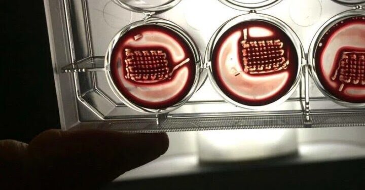 ترمیم استخوان های شکسته با خون بیمار!