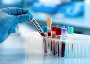 یک آزمایش خون جدید برای تشخیص پارکینسون در مراحل اولیه